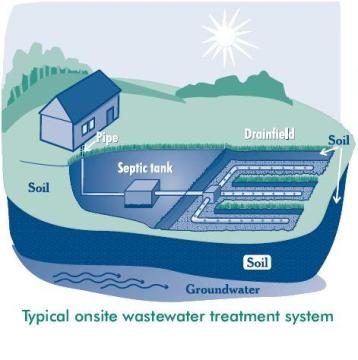 septic-5542691