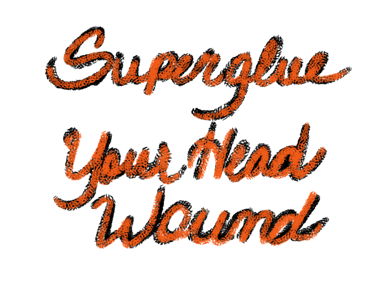 Superglue for scalp wounds
